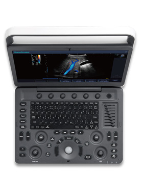 E1-Black-and-White-Portable-SonoScape-Ultrasound-Machine